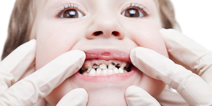 رشته دندانپزشکی کودکان در قم راه‌اندازی می‌شود